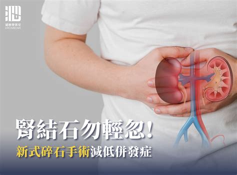 腎結石新式碎石手術減低併發症 包皮槍 割包皮健保 泌密會客室