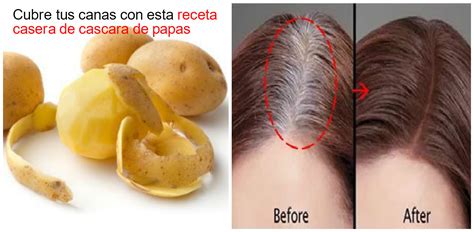 Cubre Tus Canas Con Receta Casera De Cascaras De Papa ~