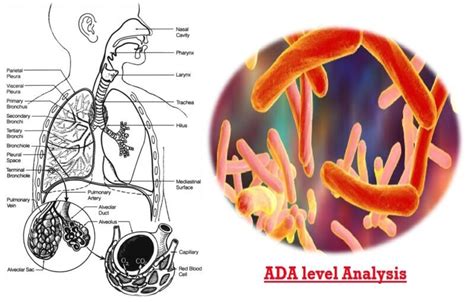 Adenosine Deaminase Ada Medicoinfo