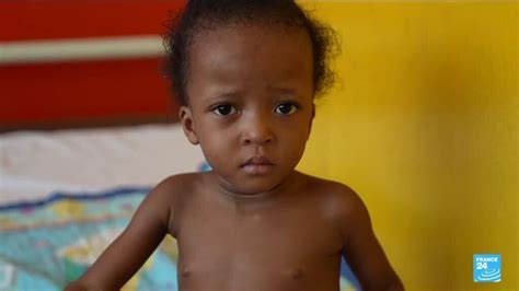 Reportage en Haïti la malnutrition des enfants explose