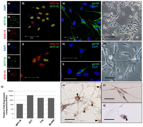 IPSC Derived Melanocytes Express Normal Melanocyte Markers And Produce