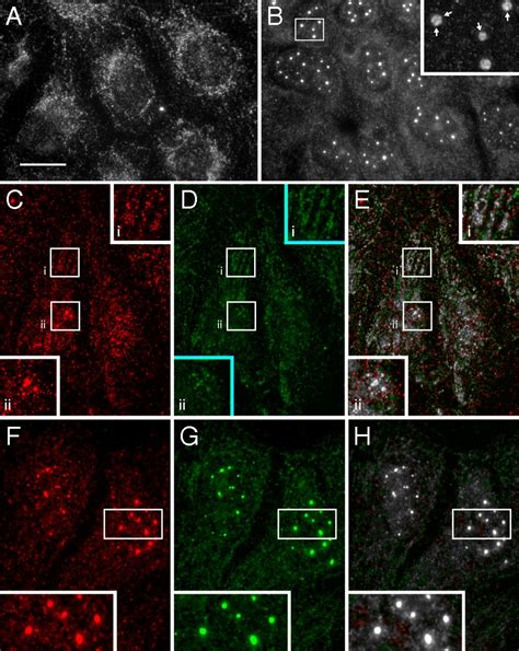 Pi5p4kγ Functions In Dtx1 Mediated Notch Signaling Pnas