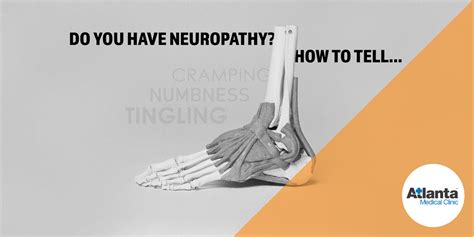 Do You Have Neuropathy Heres How To Tell Atlanta Medical Clinic