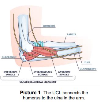 Ulnar Collateral Ligament Tear