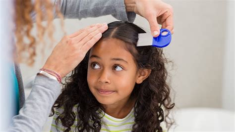 Essential Guide For Parents How To Properly Check For Head Lice Lice