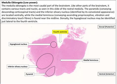 Brain Medulla Nus Pathweb Nus Pathweb