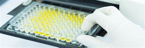 Elisa Guide Part Introduction To Elisa Formats And Signal Hot Sex Picture