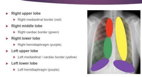 Lab Med Abnormal Chest X Ray Flashcards Quizlet