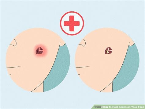 Ways To Heal Scabs On Your Face Wikihow