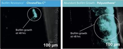 Access Scientific Announces The First Non Coated Intravascular Catheter