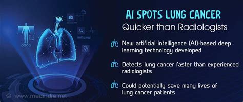 Artificial Intelligence Detects Lung Cancer Before Radiologists