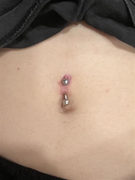 Is My Navel Piercing Rejecting R Piercing