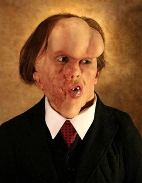 The Heartbreaking Story Of Joseph Merrick The Elephant Man Who Sought