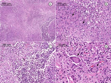 Photomicrographs Of A Cervical Lymph Node Biopsy Sample Lymphoid Download Scientific Diagram