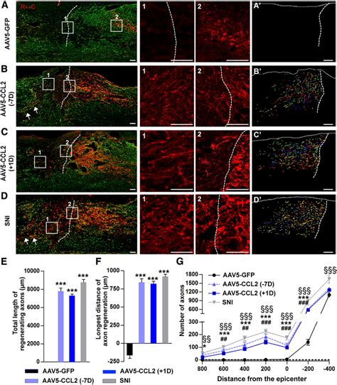 CCL2 Overexpression Promotes Axon Regeneration In A Spinal Cord Injury