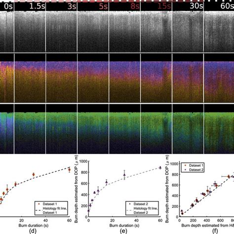 A Representative Cross Sectional OCT Intensity Image A Birefringence