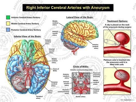 Cerebral Arteries Anatomy