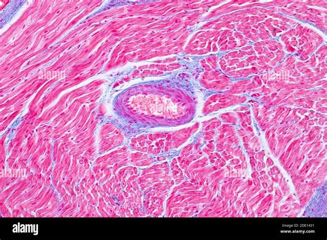 Human Cardiac Muscle Light Micrograph Stock Photo Alamy