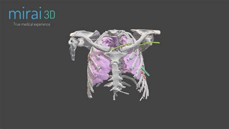 Medical Model Wp D Model By Mirai D A F Sketchfab