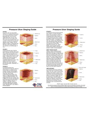 Fillable Online Pressure Ulcer Staging Guide Fax Email Print Pdffiller