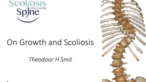 On Growth And Scoliosis With Dr Tsmit Netherlands Ssol Global