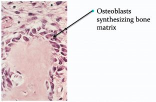 Msk Pathology Flashcards Quizlet