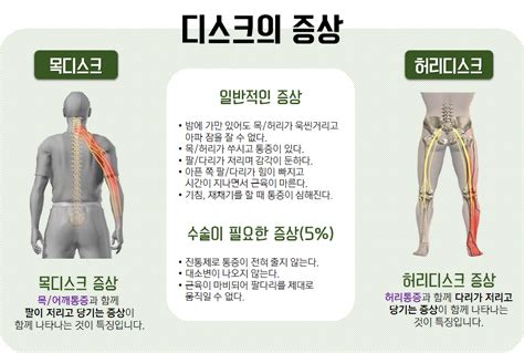 허리디스크 증상