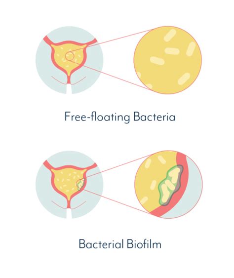 The Role Of Biofilms In Chronic UTIs – Native Formulas