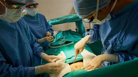 APENDICITIS Diez síntomas para reconocer un ataque de apendicitis