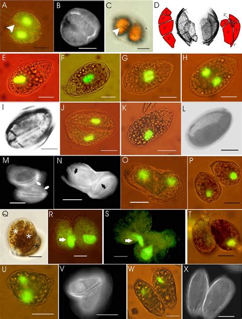 Figure 3 From Life Cycle Stages Of The Benthic Palytoxin Producing Dinoflagellate Ostreopsis Cf