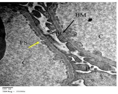 An Electron Photomicrograph Of The Glomerulus C Group Iii Showing