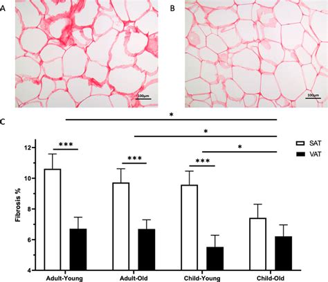 Histologic Measurements Of Adipose Tissue Fibrosis Representative Download Scientific Diagram