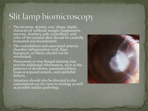 Infectious Keratitis Ppt