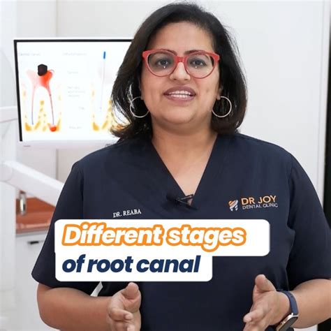 Dr Joy Dental Clinic Dubai On Linkedin Different Stages Of Root Canal