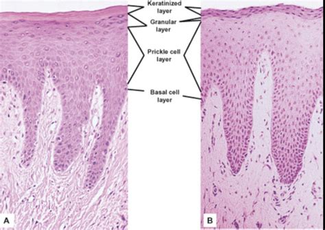 Pathology Flashcards Quizlet