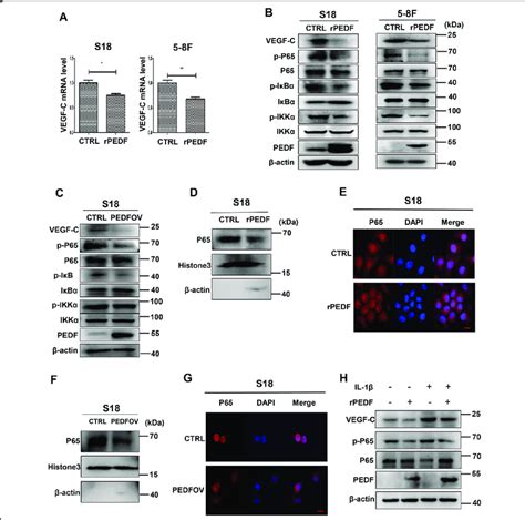 Pedf Downregulates The Expression Of Vegf C Through Ikkiҡbnf ҡb