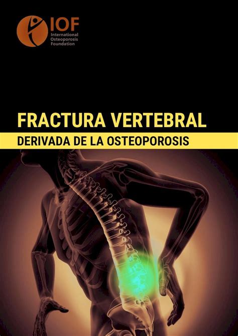 Pdf Derivada De La Osteoporosis La Fractura