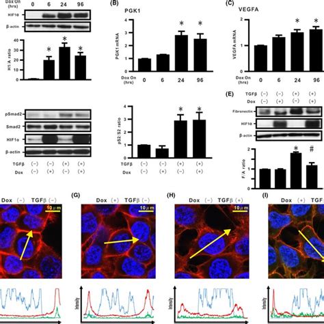 Effect of hypoxia inducible factor HIF 1α lacking oxygendependent