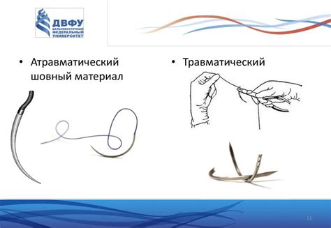 Шовный материал в хирургии - презентация онлайн