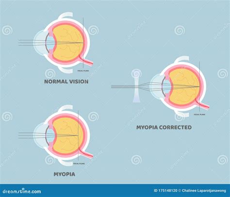 Anatomie Van De Oogbol Inwendige Organen Van Het Lichaam Deel