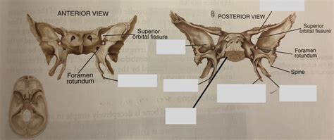 Lateral Pterygoid Plate Of Sphenoid Bone