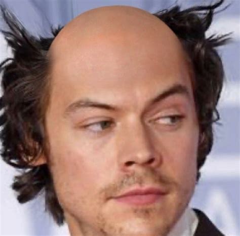 Harry Bald Styles Bald Person Famous Bald People Balding