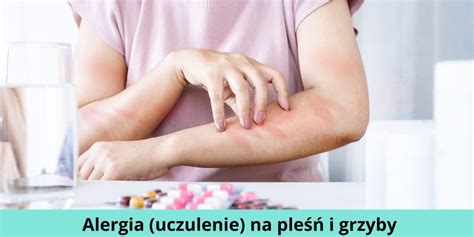 Alergia Uczulenie Na Ple I Grzyby Objawy Leki Domowe Sposoby