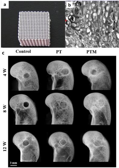 Ijms Free Full Text Application Of 3d Printed Plga Based Scaffolds In Bone Tissue Engineering