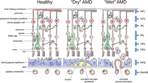 Anatomy of the human retina and changes in AMD. A healthy retina ...