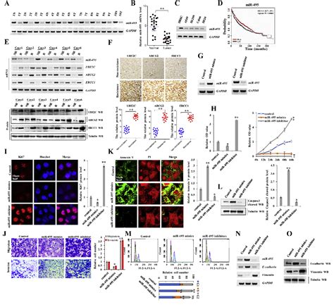 Figure 1 From The MiR 495 UBE2C ABCG2 ERCC1 Axis Reverses Cisplatin