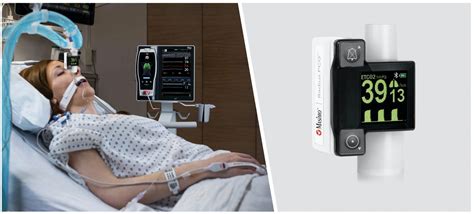 Masimo gets FDA approval for Radius PCG for use with Root platform