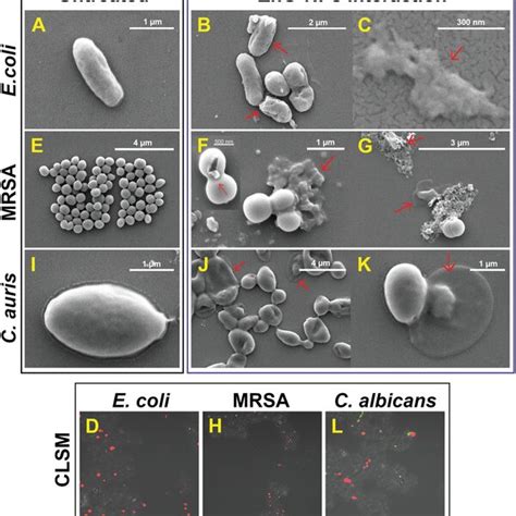 Sem Images Of A Control E Coli B C Znotreated E Coli And D Clsm