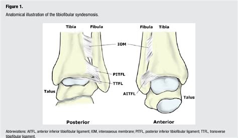 Figure 1 From Weight Bearing Radiographic Analysis Of The Tibiofibular