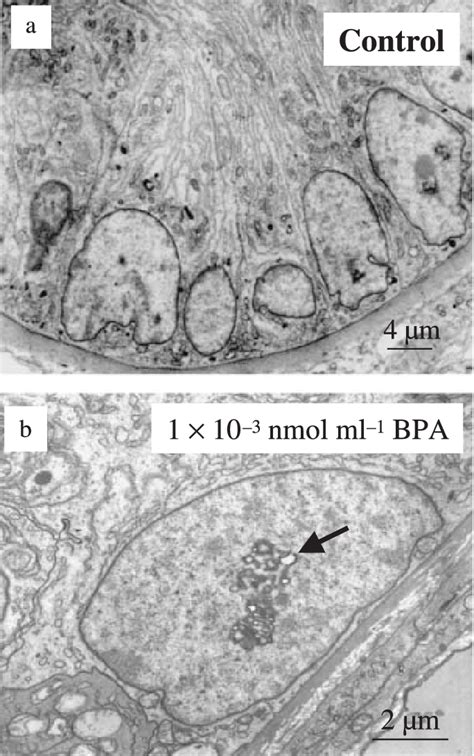 Transmission Electron Micrograph Showing The Testicular Tissue Culture